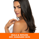 Woman advertising Palmer's Vitamin E Body Butter for dry skin.