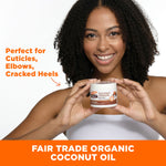 Woman holding Palmer's Coconut Hydrate Body Balm, highlighting moisturizing benefits.