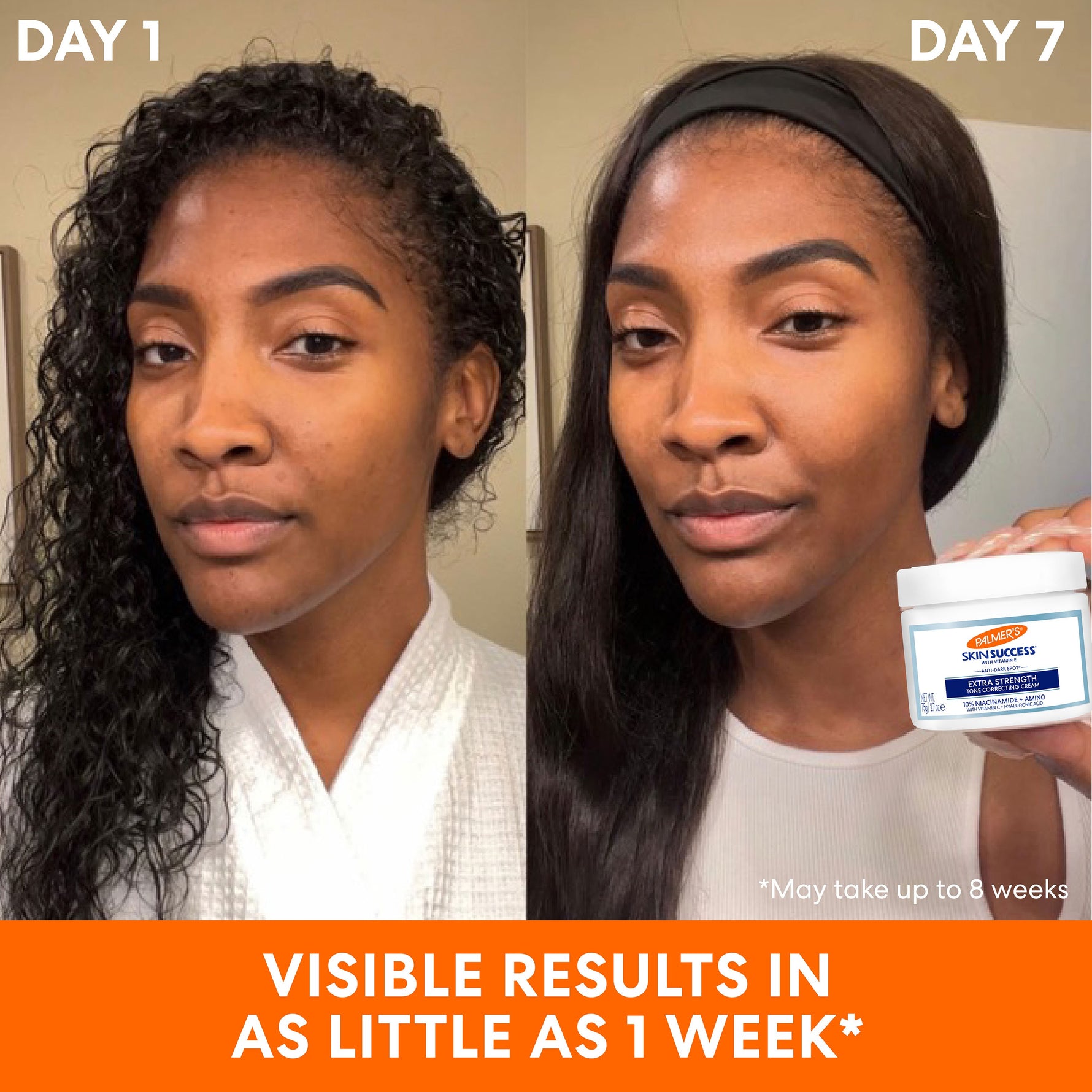 Before and after using Palmer’s Anti-Dark Spot Extra Strength Tone Correcting Serum.