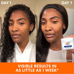 Before and after using Palmer’s Anti-Dark Spot Tone Correcting Cream.