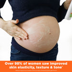 Pregnant woman applying Cocoa Butter Massage Lotion for Stretch Marks.