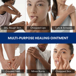 Collage of people with skin conditions and text indicating the use of a multi-purpose healing ointment.