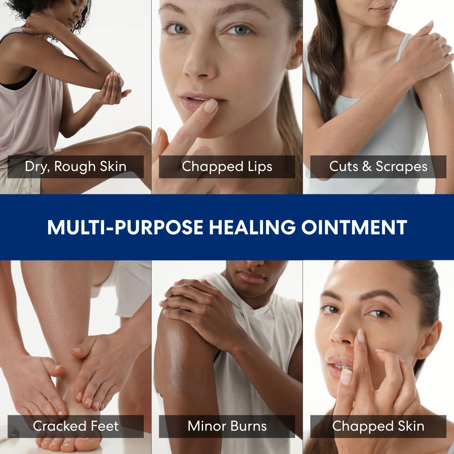 Collage of people with skin conditions and text indicating the use of a multi-purpose healing ointment.