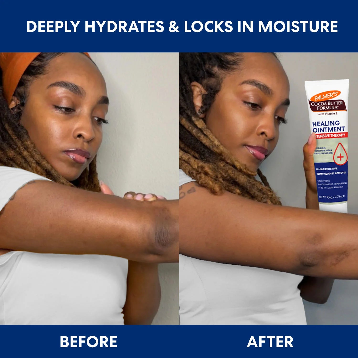 Before and after comparison of a woman's arm with a product for moisturizing.